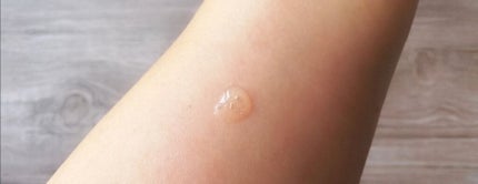 リペアジェル/リソウコーポレーション/美容液を使ったクチコミ(4枚目)