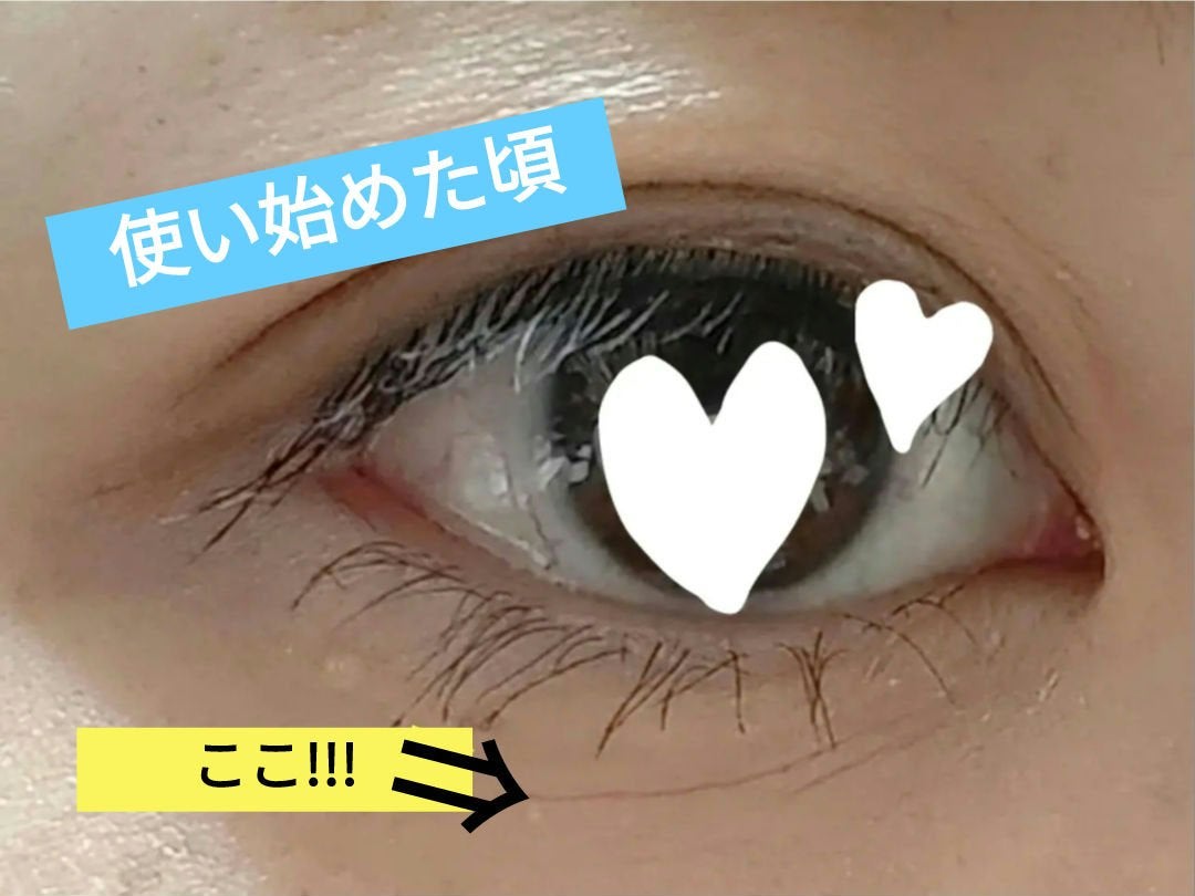 ããã³ ã¢ããã¢ã€ã¹ã ãšã€ãžã³ã°ã±ã¢ ãã€ã¯ãªãŒã UV/ããã³/æ¥çŒãæ¢ãã¯ãªãŒã ã䜿ã£ãã¯ãã³ãïŒ2æç®ïŒ