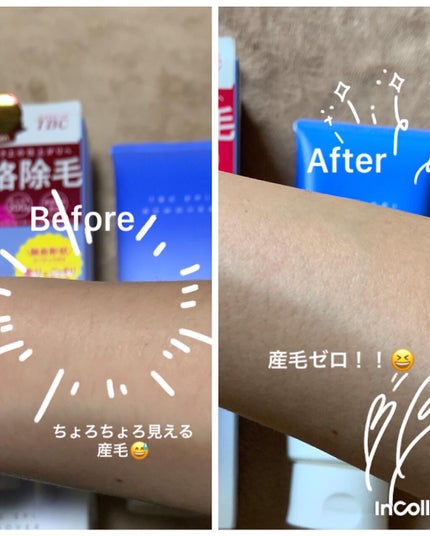 エピリムーバー N/TBC/除毛クリームを使ったクチコミ(6枚目)