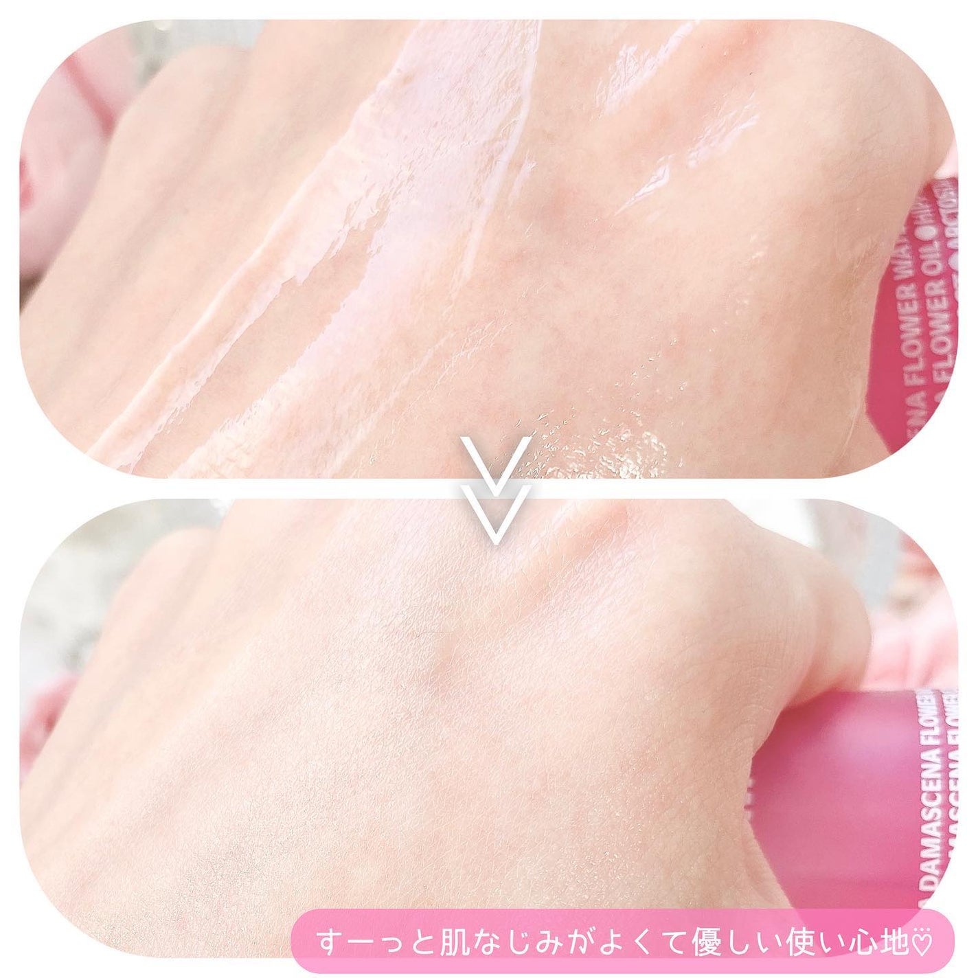 ブレミッシュケアアップ セラム/ISOI/美容液を使ったクチコミ(5枚目)