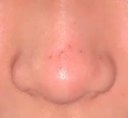 おうちdeエステ 肌をなめらかにする マッサージ洗顔ジェル/ビオレ/その他洗顔料を使ったクチコミ(2枚目)