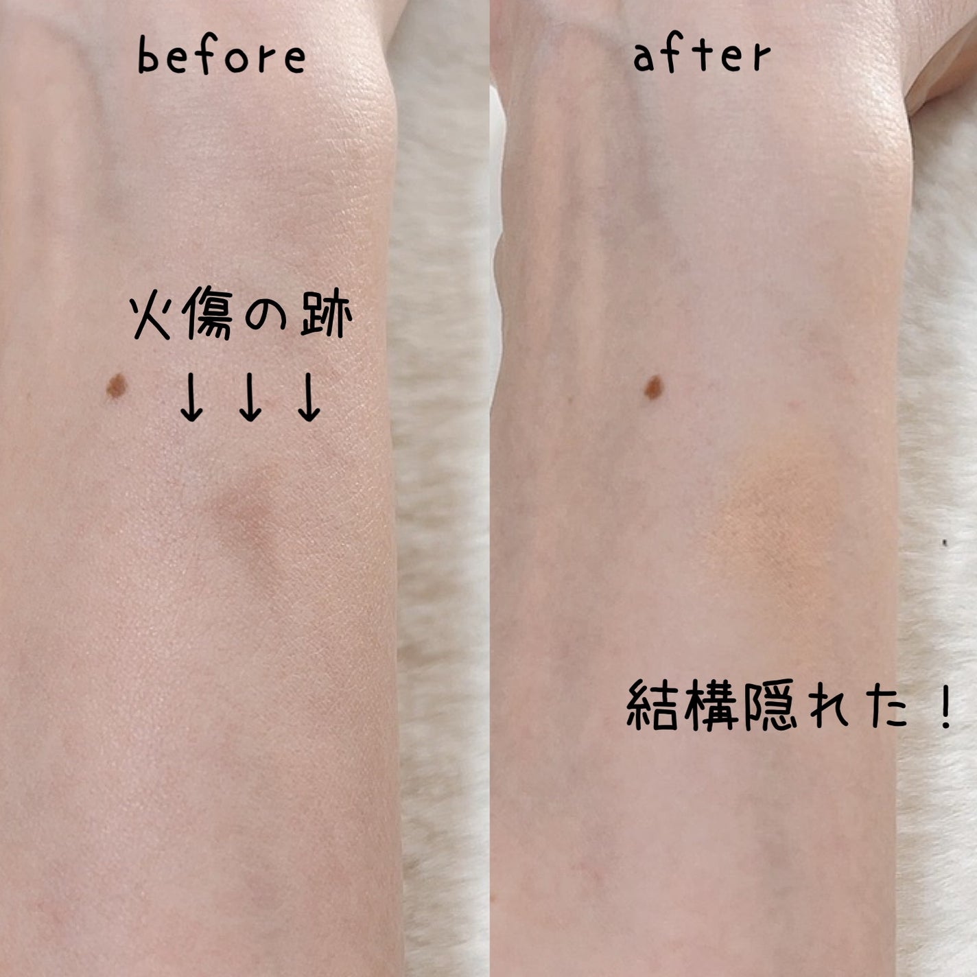 マジックコンシーラー/カリプソ/リキッドコンシーラーを使ったクチコミ(4枚目)