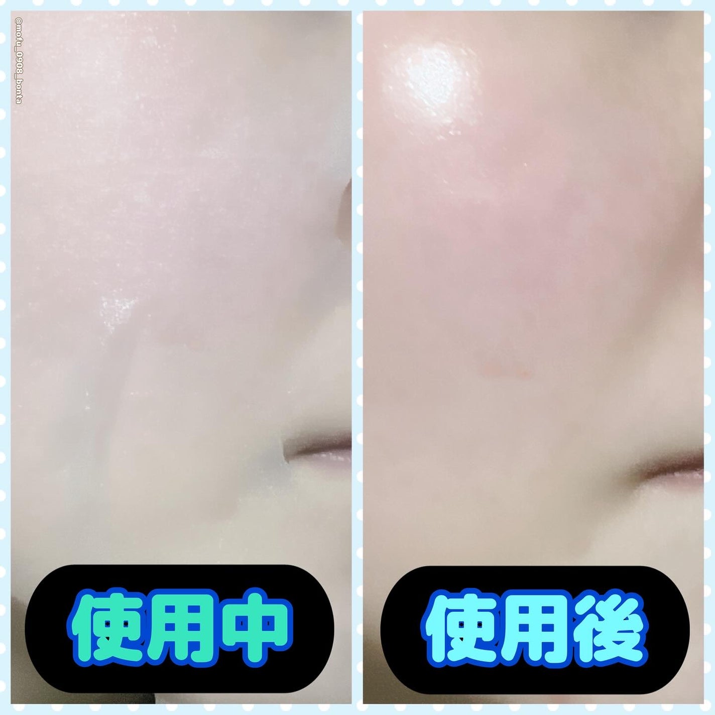 CPフェイスマスク G/カプセルセラム/シートマスク・パックを使ったクチコミ(4枚目)