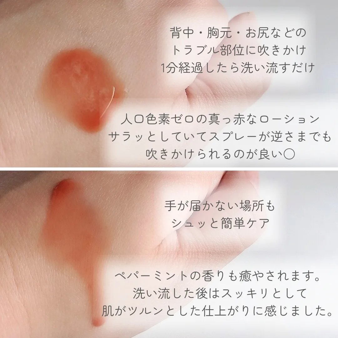 レッドアクネ ボディピーリングショット/MEDICUBE/ピーリングを使ったクチコミ（3枚目）