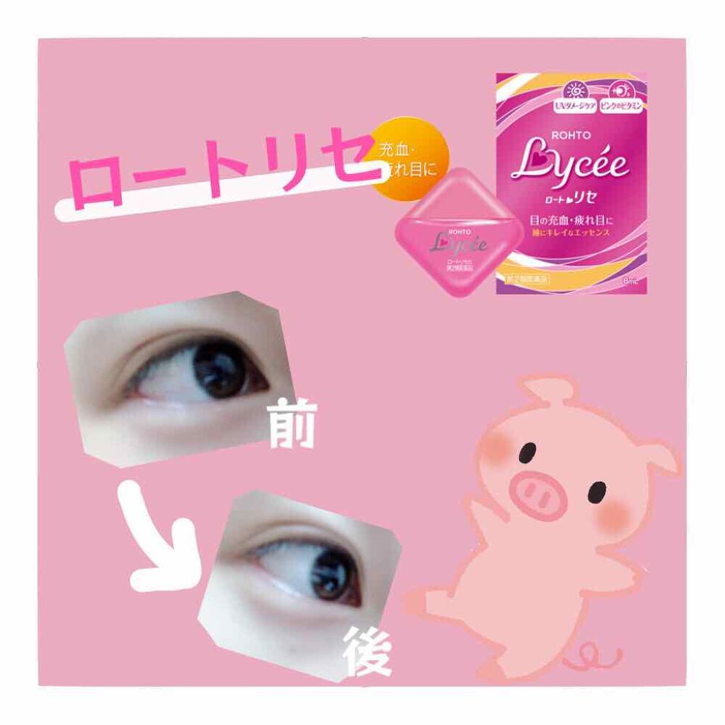 ロートリセ(医薬品)/ロート製薬/その他を使ったクチコミ(2枚目)