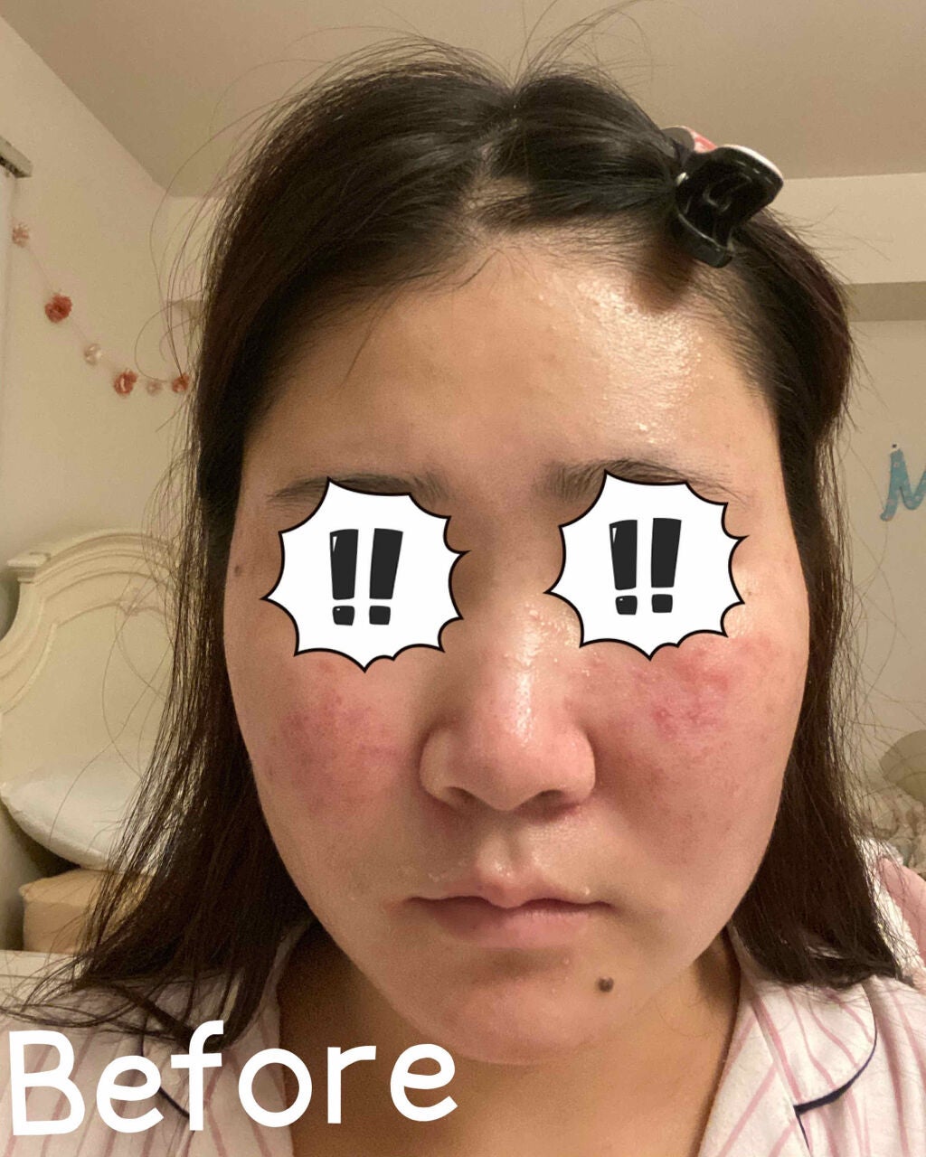 インビジブルピーリングブースターエッセンス/CNP Laboratory/ブースター・導入液を使ったクチコミ(2枚目)