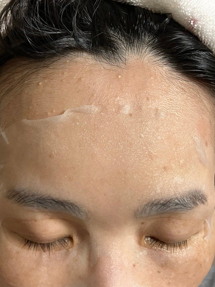 シートマスク ヒト幹細胞×VC200/CICIBELLA/シートマスク・パックを使ったクチコミ(4枚目)