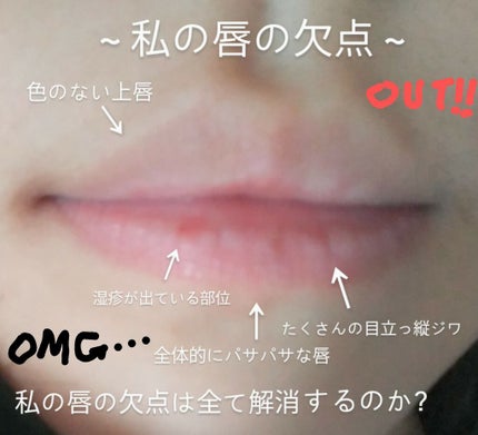 リップパック /CHOOSY/リップマスクを使ったクチコミ(2枚目)