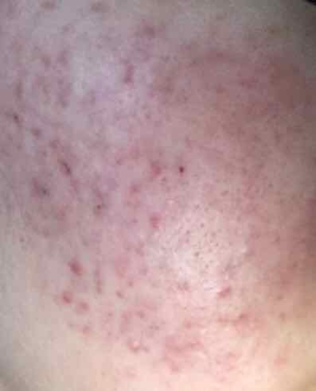 カラーミキシングコンシーラー/キャンメイク/パレットコンシーラーを使ったクチコミ(3枚目)