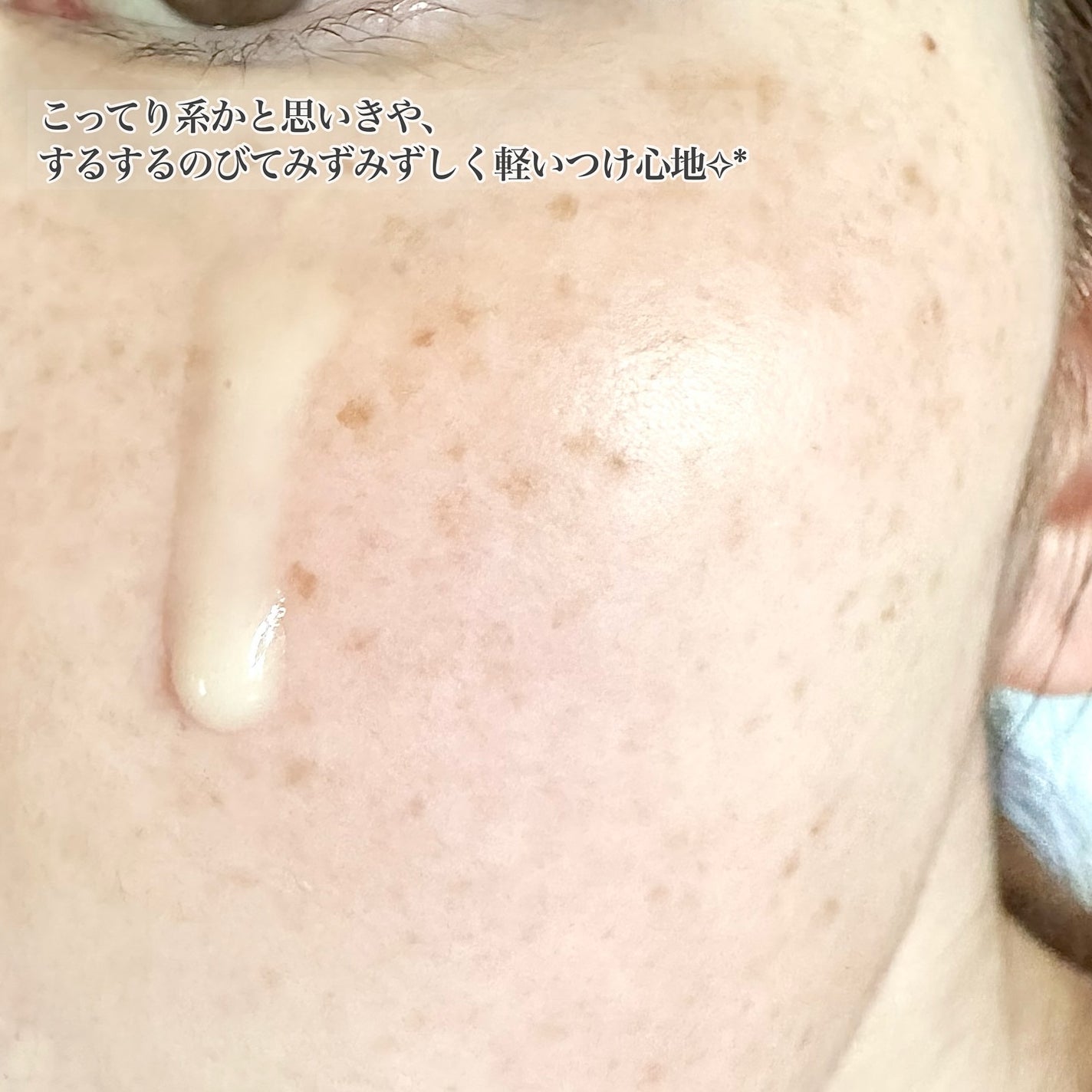 ブラックスネイルレチノールセラム/Dr.G/美容液を使ったクチコミ(4枚目)