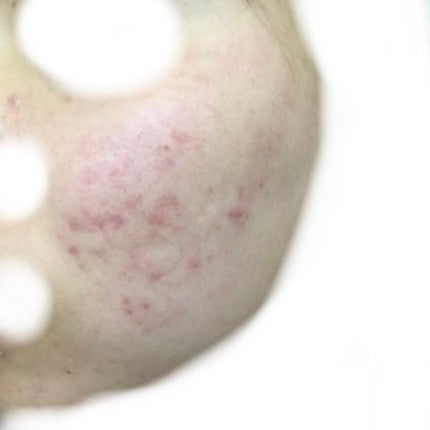 化粧水・敏感肌用・高保湿タイプ/無印良品/化粧水を使ったクチコミ(3枚目)