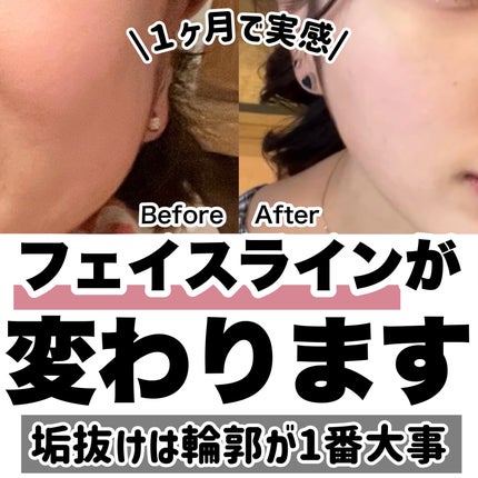 クラブ ホルモンクリームのクチコミ「【まじで試してみて】1ヶ月でフェイスラインを劇的に綺麗にする方法㊙️⬇️
騙されたと思って試.....」(1枚目)
