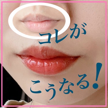 トマ🐥 on LIPS 「最強の唇を作る3step🕒💄ㅤㅤ元の色がない私がつくる落ちづら..」（1枚目）