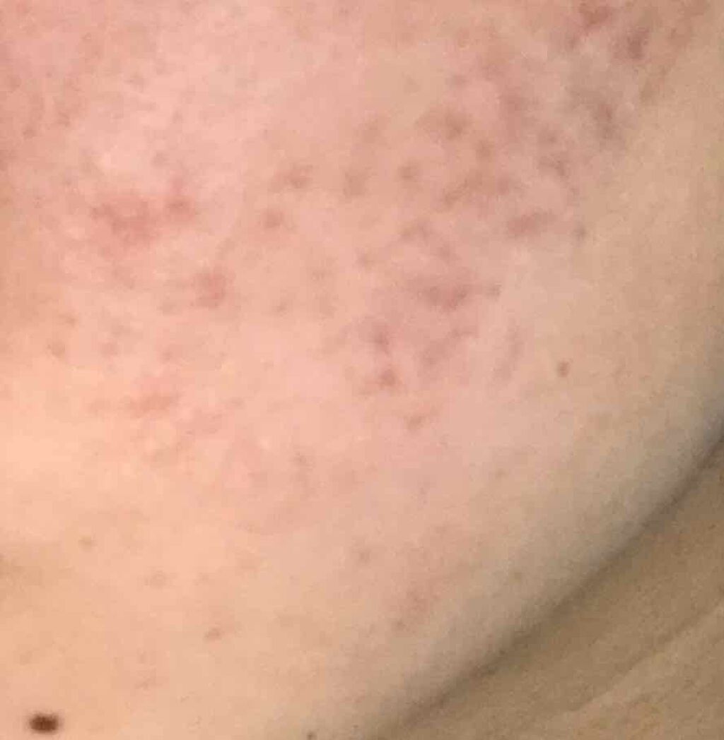 いちごあめ🍓 on LIPS 「こんにちは☺︎いちごあめ🍓です‼︎初投稿です😅酷すぎる私のニキ..」(2枚目)