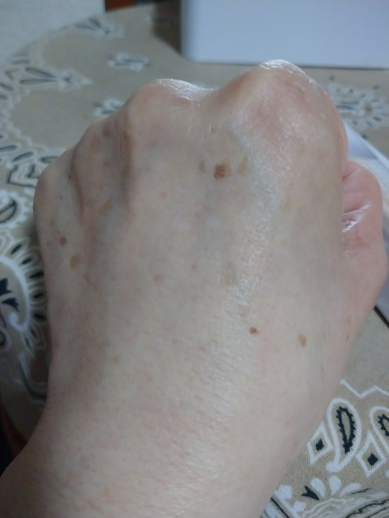 キルカバーファンウェアコンシーラー/CLIO/リキッドコンシーラーを使ったクチコミ（2枚目）