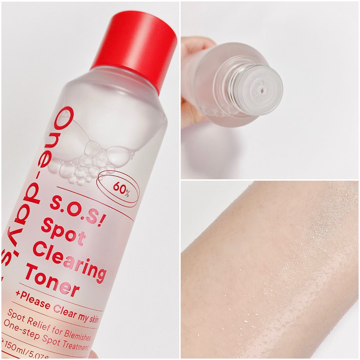 SOSスポットクリアトナー/One-day's you/化粧水を使ったクチコミ(2枚目)