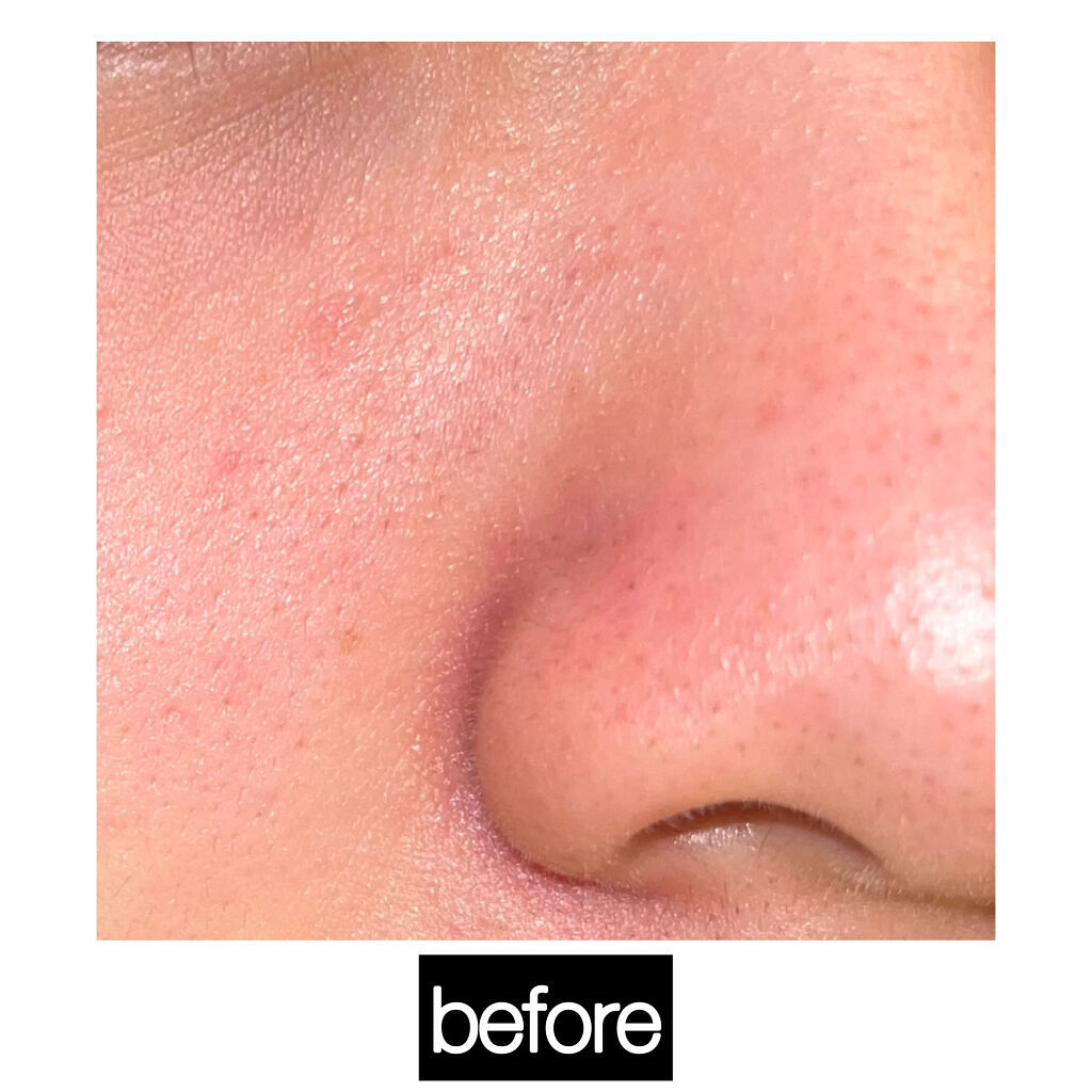 お米のパック/毛穴撫子/洗い流すパック・マスクを使ったクチコミ（2枚目）