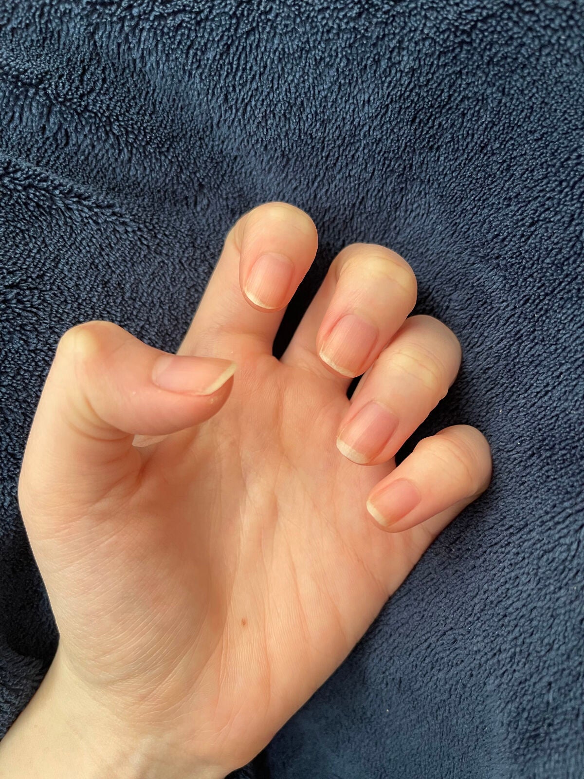 ネイルトリートメントオイル/カントリー&ストリーム/ネイルオイル・トリートメントを使ったクチコミ(4枚目)