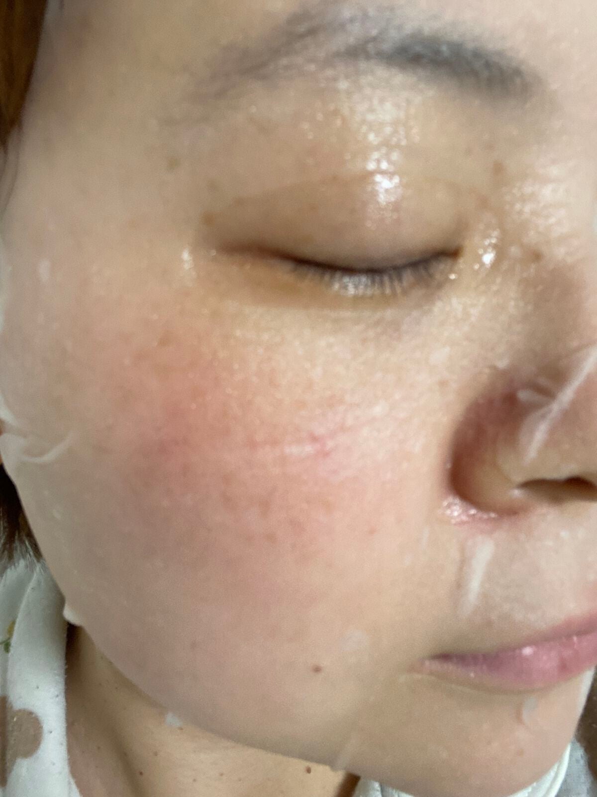 フェイスマスク 【しっかり実感30枚セット】/KISO/シートマスク・パックを使ったクチコミ(4枚目)