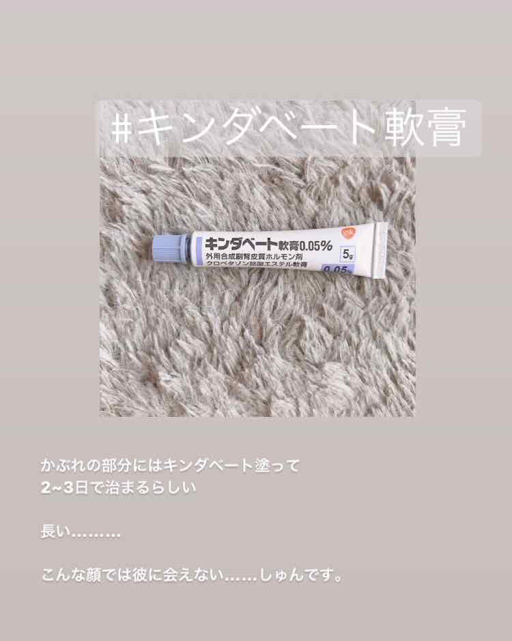 キンダベート軟膏0 05 医薬品 グラクソ スミスクライン コンシューマー ヘルスケア ジャパンの口コミ 4枚目に赤みが出た写真があります ニキビが By Wkck 混合肌 代後半 Lips