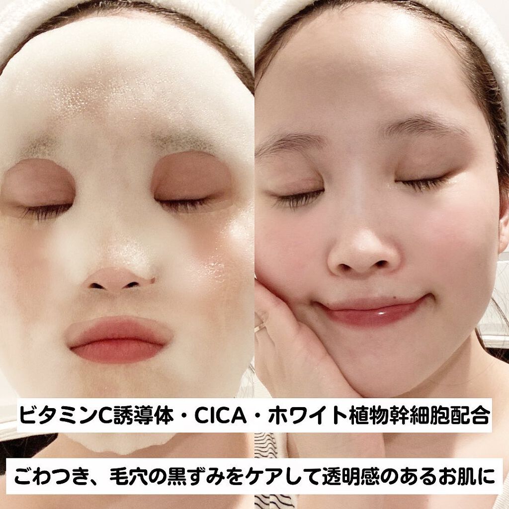 もこもこビタミンC泡マスク/リッツ/シートマスク・パックを使ったクチコミ（3枚目）