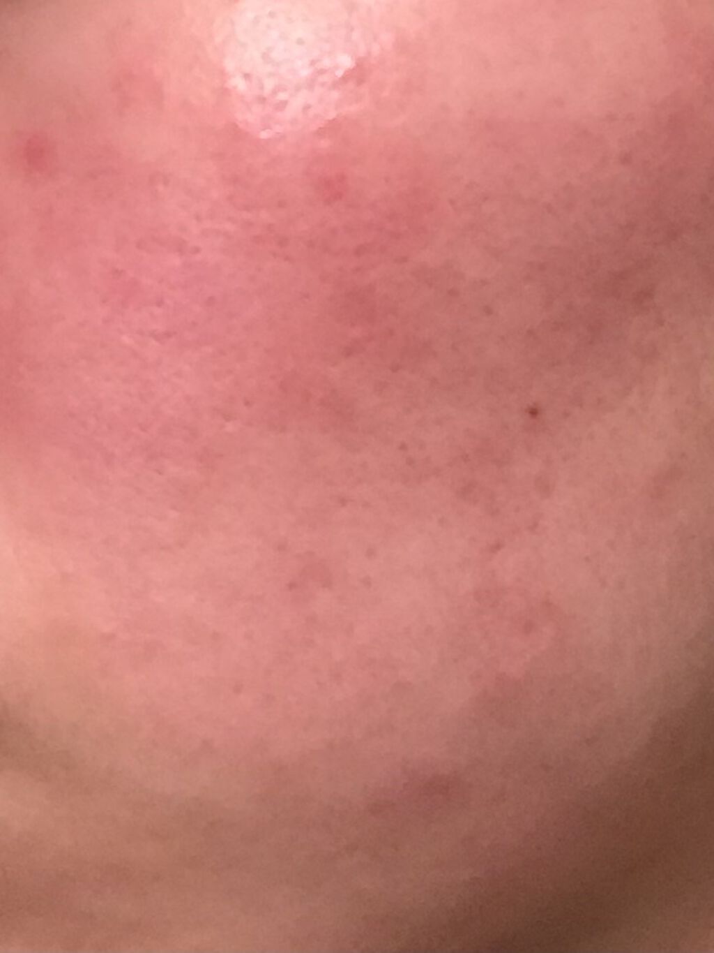 艶肌ドロップ/ラッシュ/美容液を使ったクチコミ（2枚目）