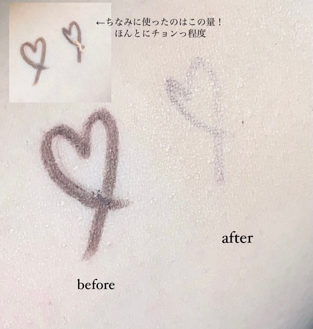 【旧】ディオールスキン フォーエヴァー スキン コレクト コンシーラー/Dior/リキッドコンシーラーを使ったクチコミ(2枚目)