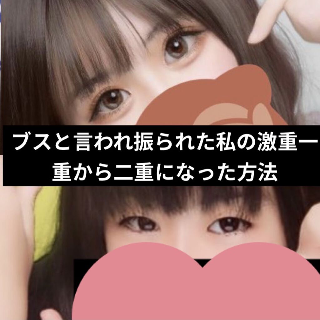 二重まぶた用シール/DAISO/二重まぶた用アイテムを使ったクチコミ（1枚目）