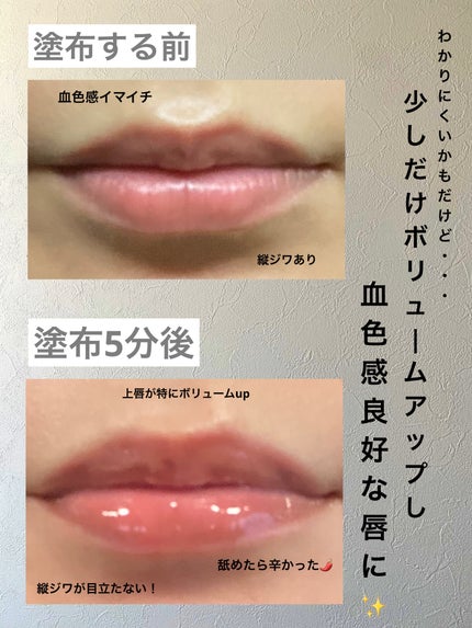 リードルS リッププランパーエキスパート/VT/リッププランパーを使ったクチコミ(2枚目)