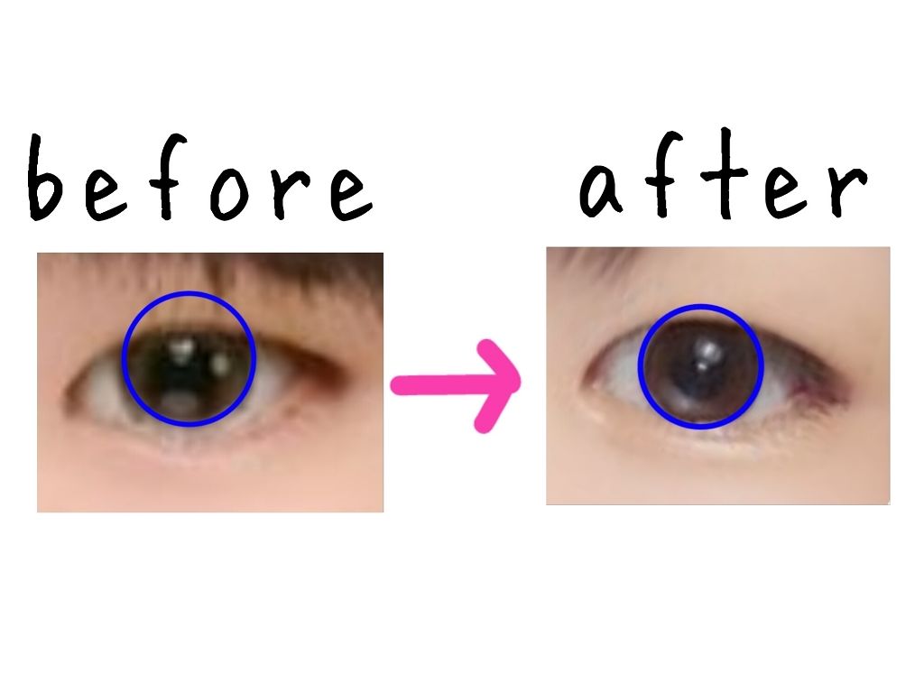 アイトーク/アイトーク/二重まぶた用アイテムを使ったクチコミ（2枚目）