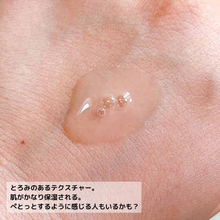 モイストケア ローション MB/d プログラム/化粧水を使ったクチコミ(9枚目)