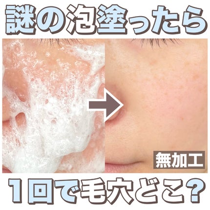 試してみた】Urar スパークリングパックの効果・肌質別の口コミ 試してみた】Urar スパークリングパックの効果・肌質別の口コミ