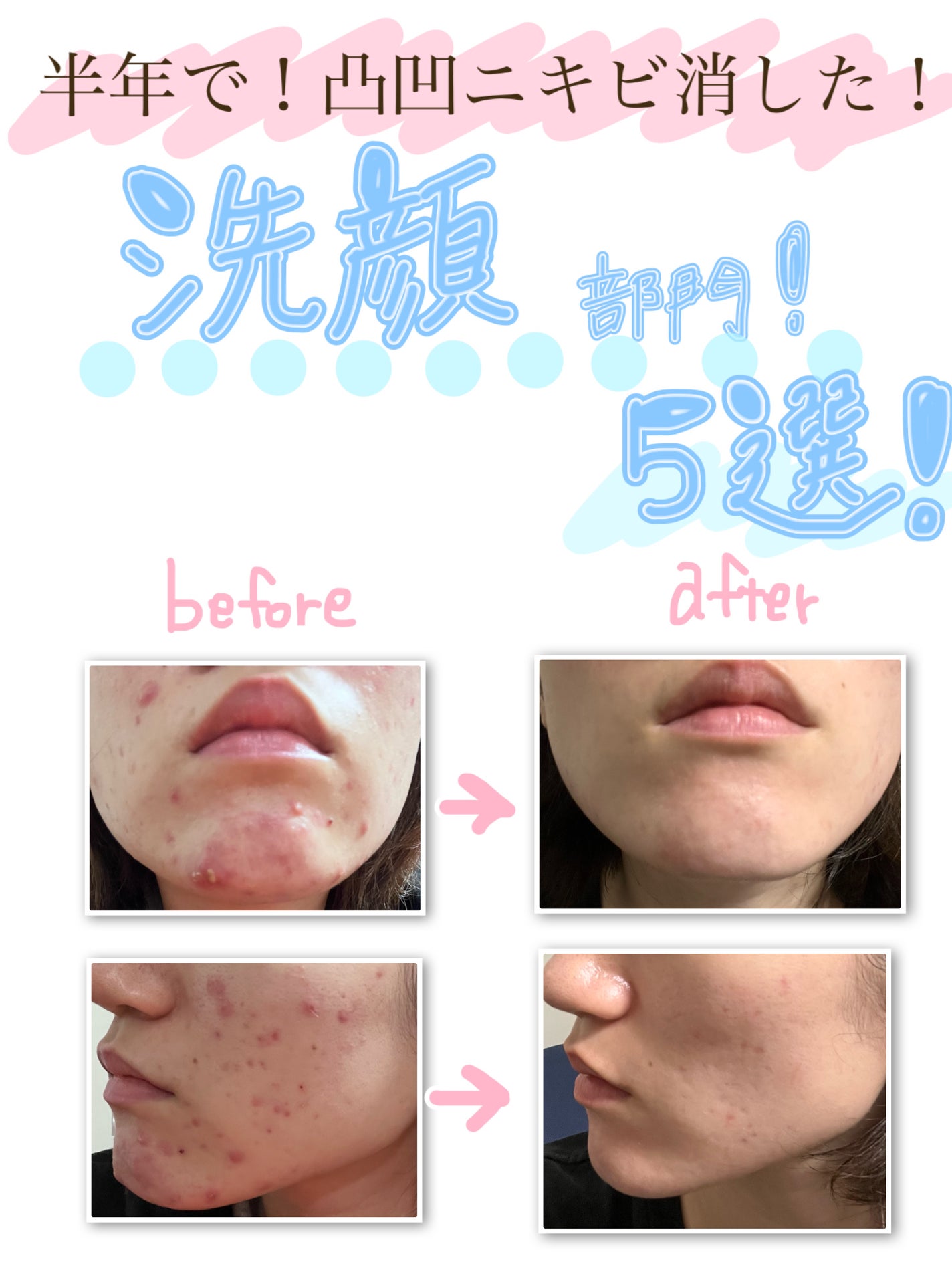 潤浸保湿 泡洗顔料/キュレル/泡洗顔を使ったクチコミ(1枚目)