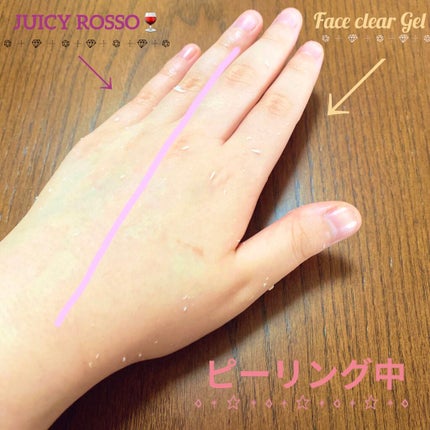 ワンダーハニー ジューシーロッソ 角質ソフナー/VECUA Honey/ピーリングを使ったクチコミ(3枚目)