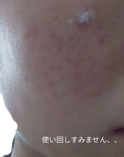 マイルド&モイスチャーアロエジェル/ネイチャーリパブリック/ボディローションを使ったクチコミ(2枚目)