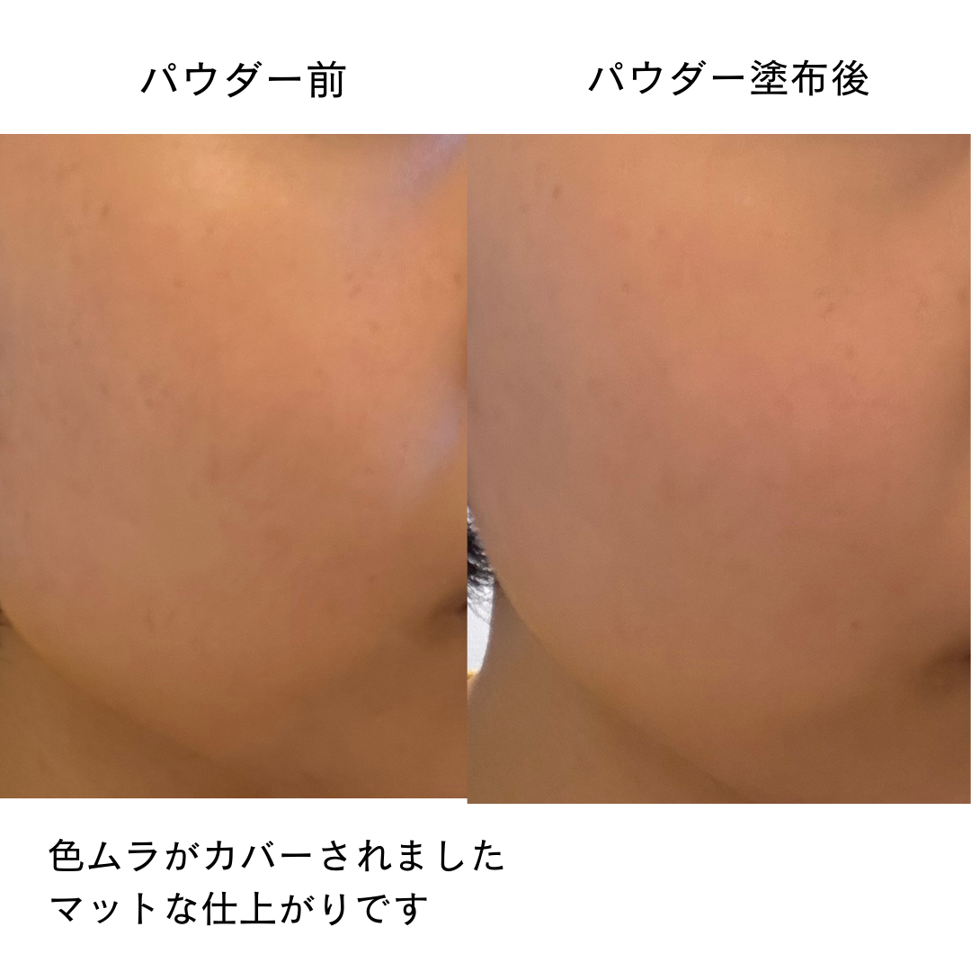 マシュマロフィニッシュパウダー　～Abloom～/キャンメイク/プレストパウダーを使ったクチコミ（3枚目）