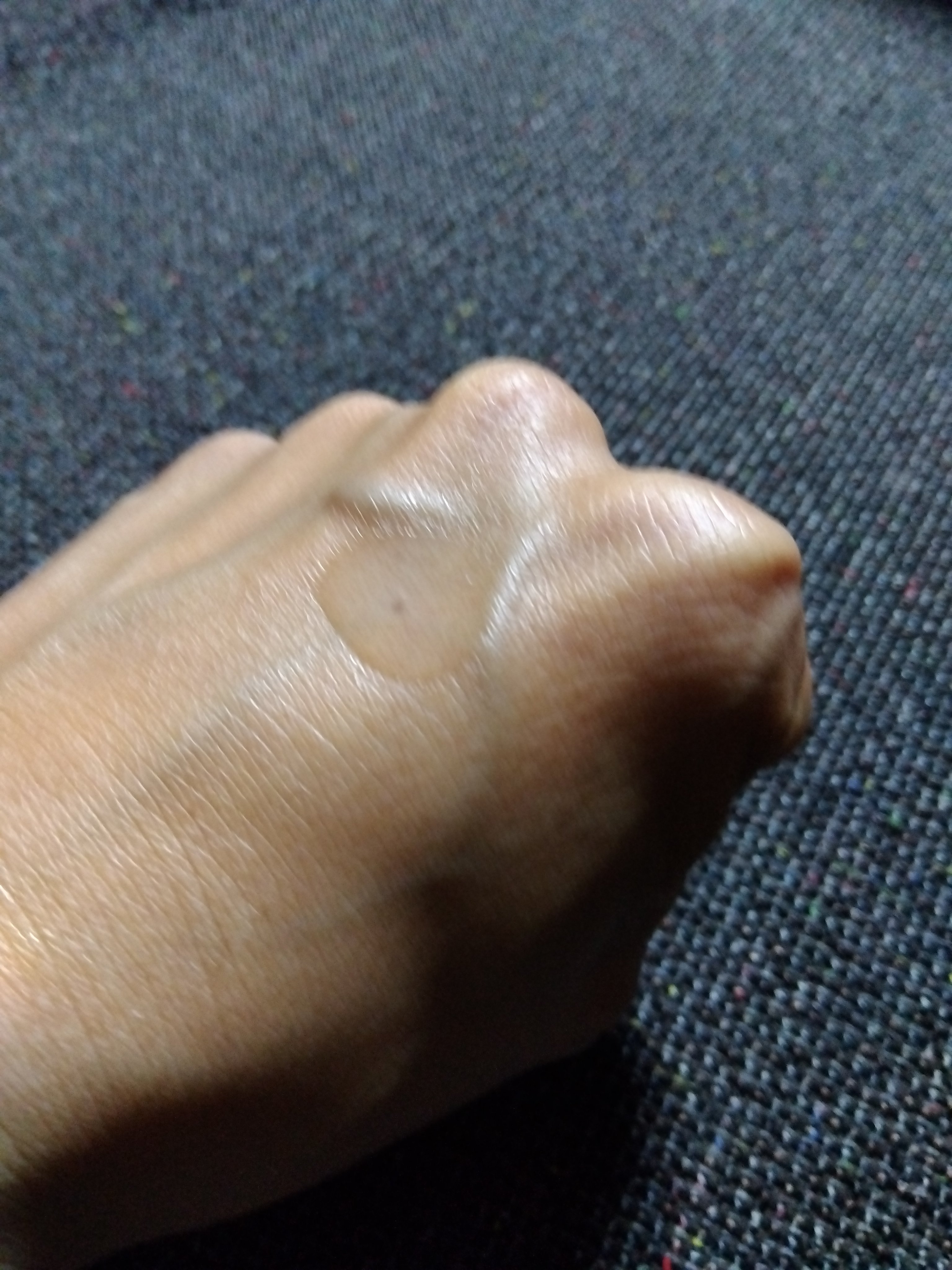 白潤プレミアム 薬用浸透美白化粧水(しっとりタイプ)/肌ラボ/化粧水を使ったクチコミ（2枚目）