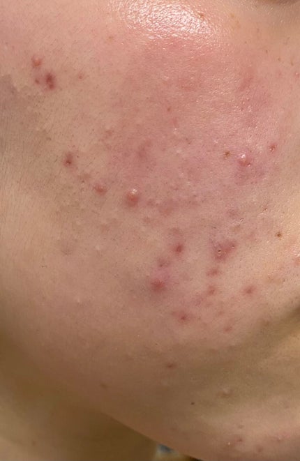 プロフィニッシュリキッド/インテグレート/リキッドファンデーションを使ったクチコミ(2枚目)