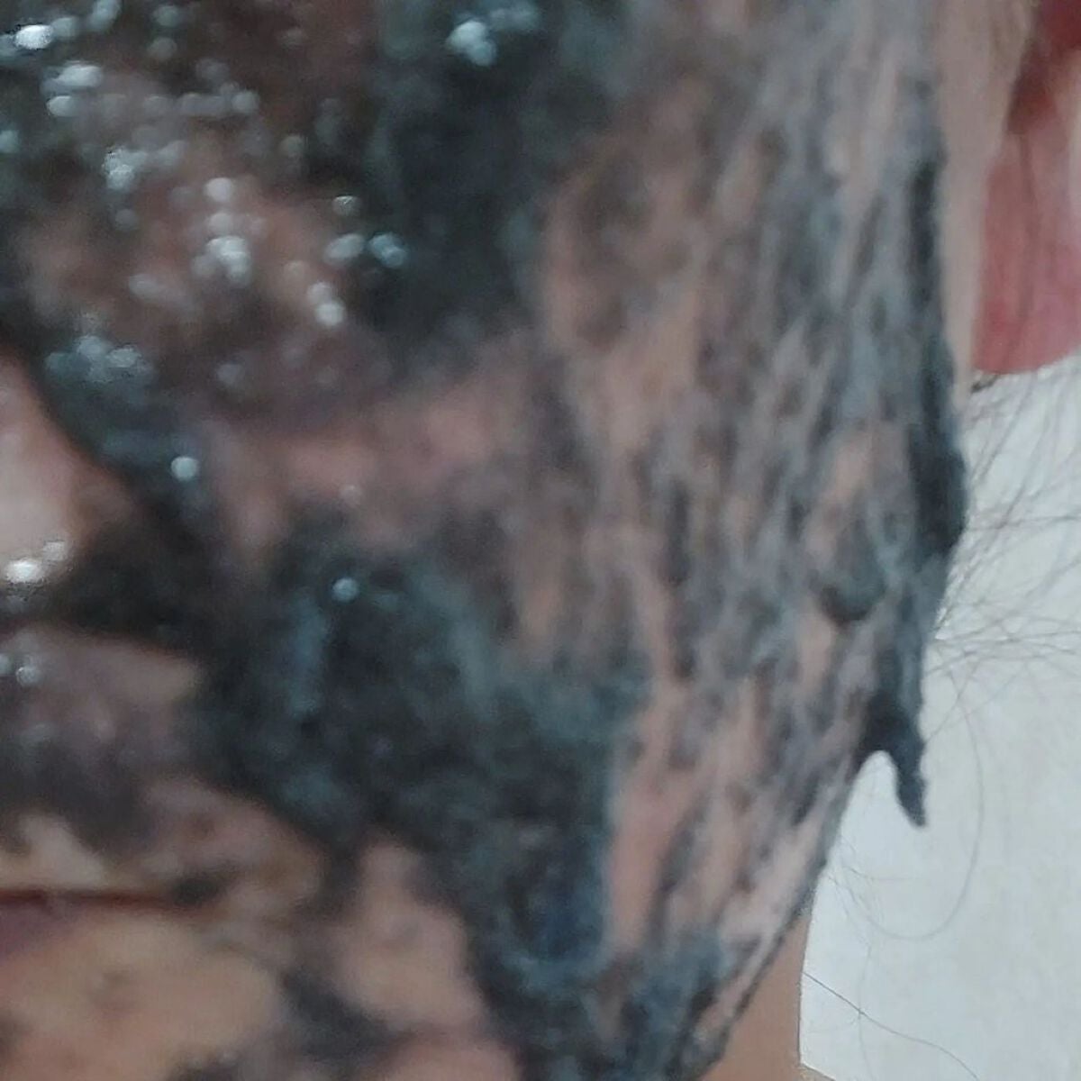 ニードル炭酸パック/NNE/洗い流すパック・マスクを使ったクチコミ(7枚目)