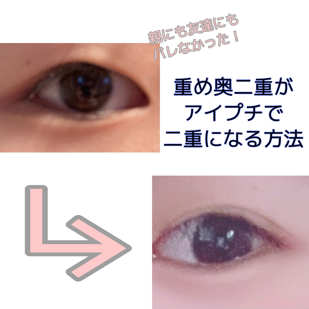 LJ ふたえまぶた用のり/セリア/二重まぶた用アイテムを使ったクチコミ（1枚目）