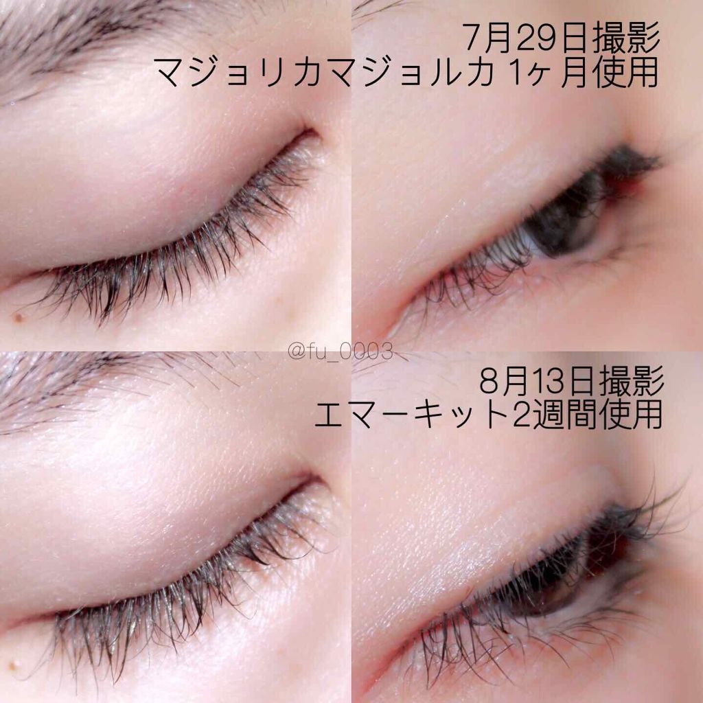 EMAKED（エマーキット）｜水橋保寿堂製薬他、2商品を使った口コミ