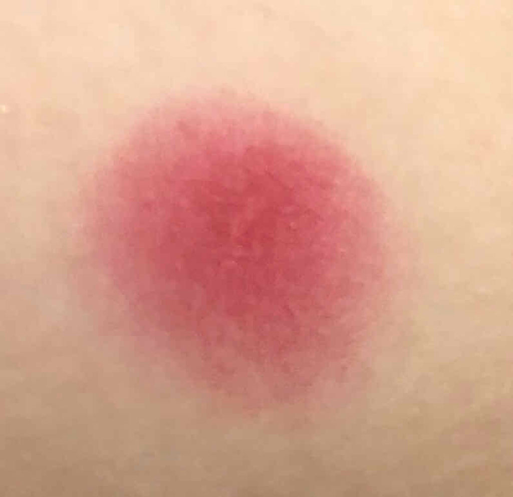 カンコレ クリームチーク/DAISO/ジェル・クリームチークを使ったクチコミ（3枚目）