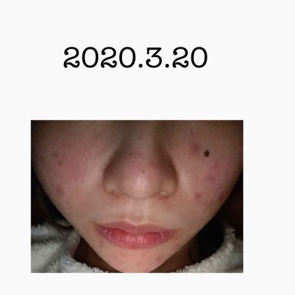 集中対策 マスク/メラノCC/シートマスク・パックを使ったクチコミ(3枚目)