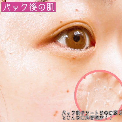 フォトピック モイスチャー スクケア マスク/JMsolution-japan edition-/シートマスク・パックを使ったクチコミ(6枚目)