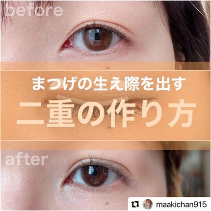 ルドゥーブル プレミアム/ルドゥーブル/二重まぶた用アイテムを使ったクチコミ(1枚目)