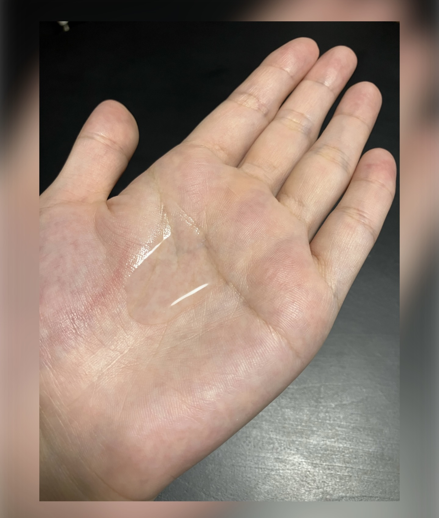 薬用保湿化粧水/オードムーゲ/化粧水を使ったクチコミ（3枚目）