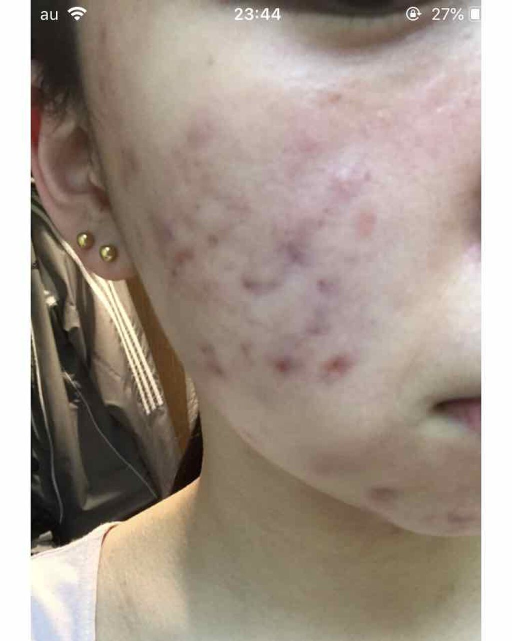 𥺠on LIPS ã#ãããè·¡ããã1æã§ãã..ãïŒ2æç®ïŒ