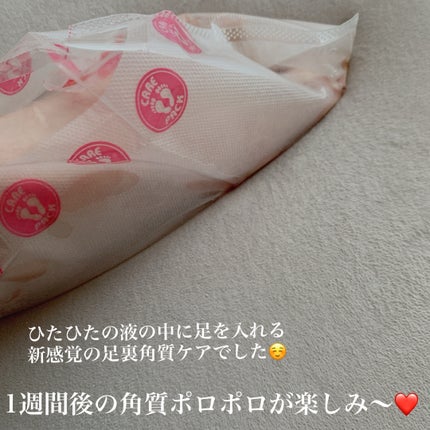 あしやすめ 足裏角質ケアパック/鎌倉ライフ/レッグ・フットケアを使ったクチコミ(3枚目)