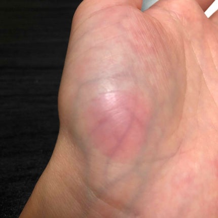 【旧】ディオール アディクト リップ グロウ/Dior/リップケアを使ったクチコミ(4枚目)