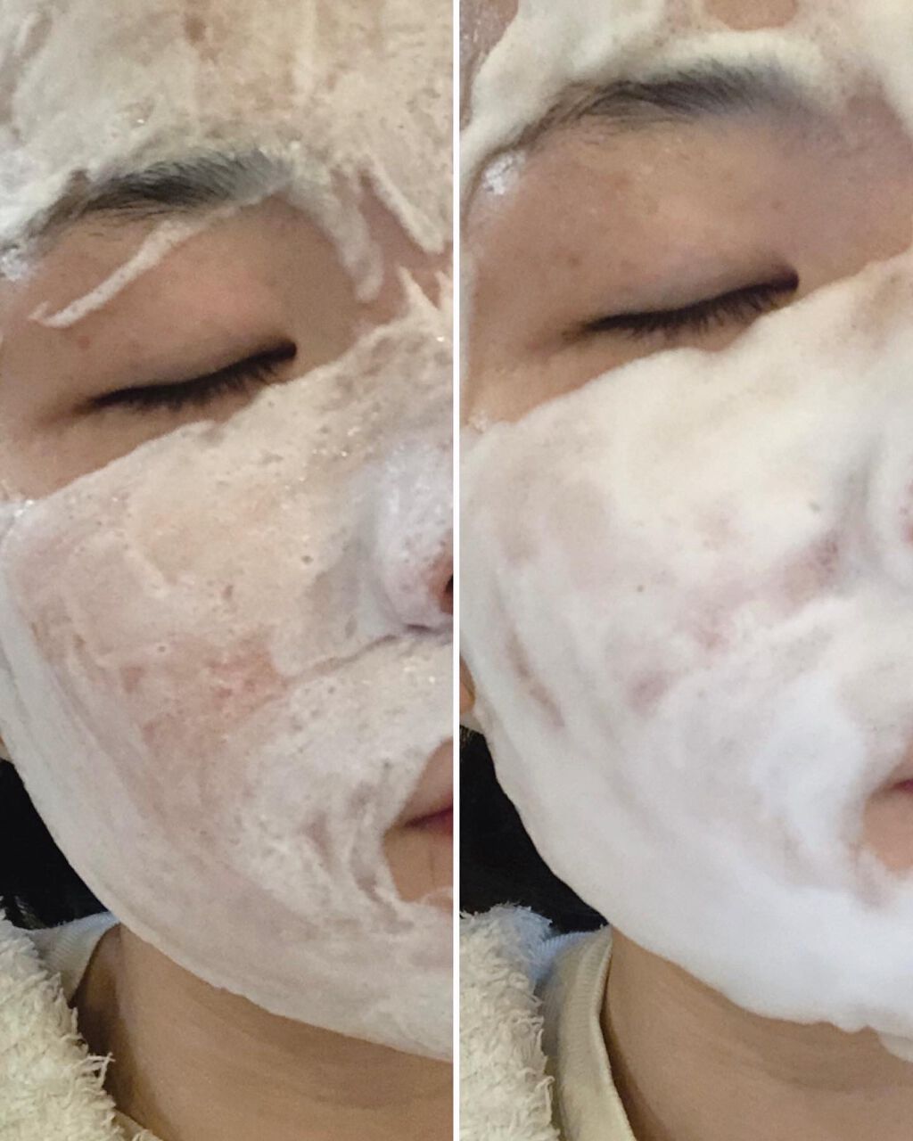 フェイシャルオイル22/ビービーラボラトリーズ/フェイスオイルを使ったクチコミ（3枚目）